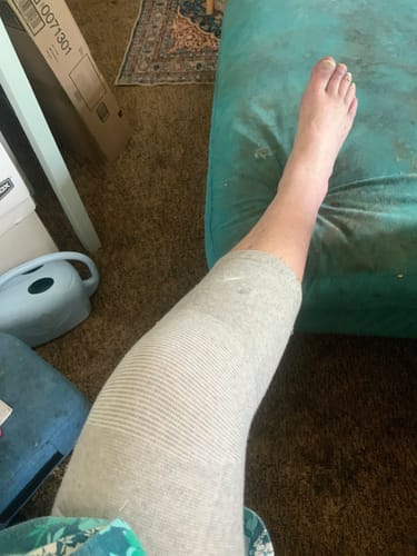 Customer photo review of Premium Bamboo Knee Sleeve (Single)