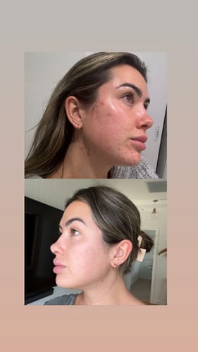 Customer photo review of Skin & Gut Maintain™