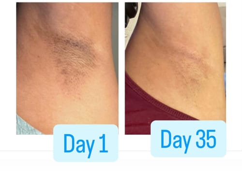 Customer photo review of Intimate Lightening Cream
