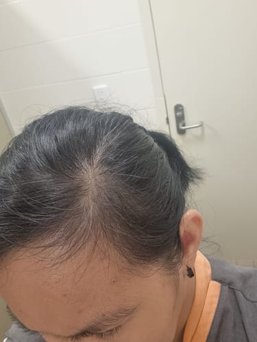 Customer photo review of Rosemary & Castor Oil for Hair Growth
