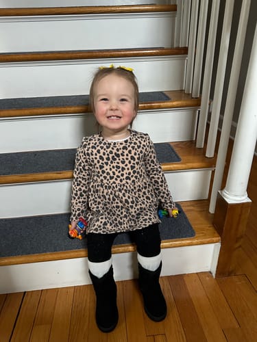 Customer photo review of All Over Ointment Eczema Treatment