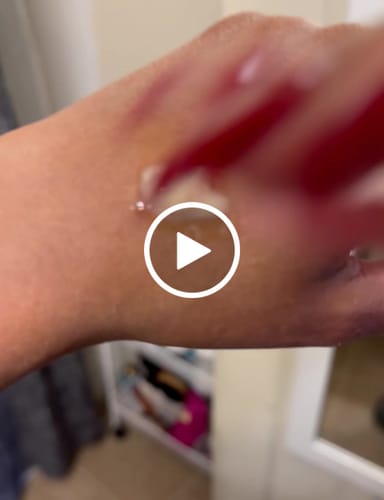 Customer video review of Psoriasis Honey Skin-Renewing Cream
