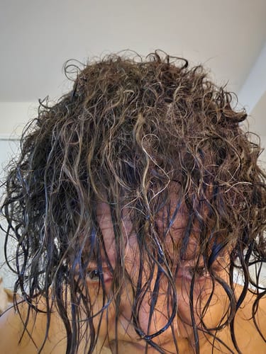 Customer photo review of COMPLETE HAIR RESTORATION & GROWTH SYSTEM