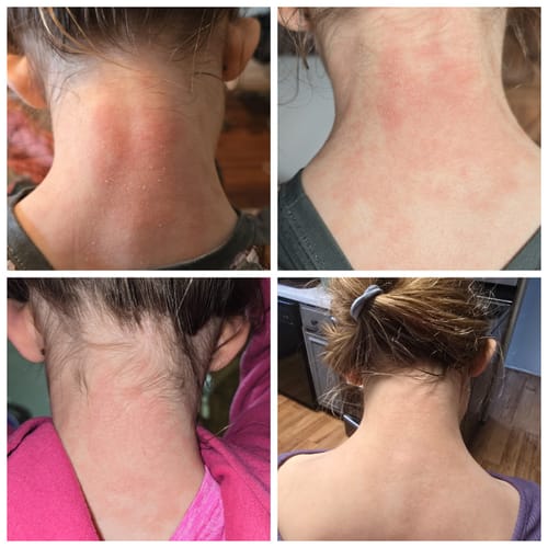Customer photo review of Bare