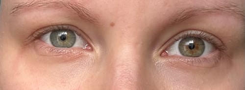 Customer photo review of PRETTY WOMEN STARTER KIT (5mm-15mm)