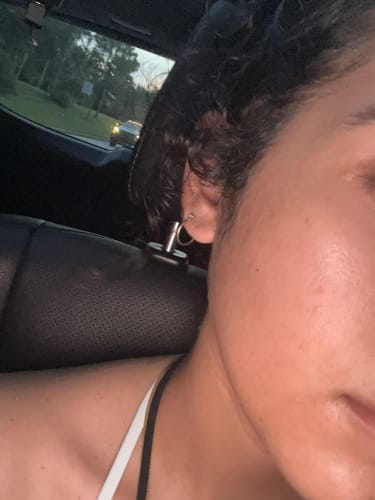 Customer photo review of Noirwild™ Turmeric Soap