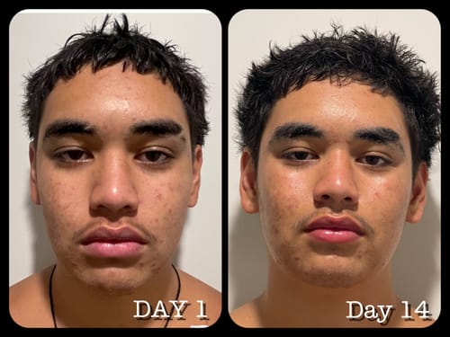 Customer photo review of Honey & Turmeric