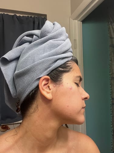 Customer photo review of The Complete Acne System for Women