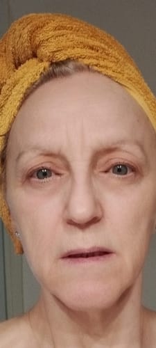 Customer photo review of Prickly pear Seed Oil ZAYANA™