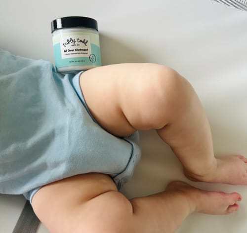 Customer photo review of All Over Ointment Eczema Treatment