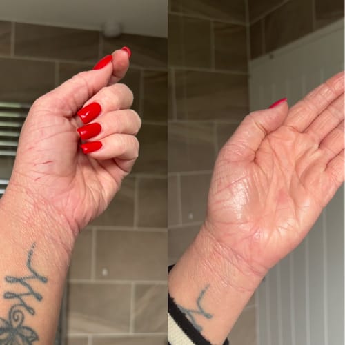 Customer photo review of Calm Balm