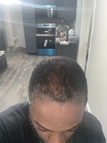 Customer photo review of NATURAL SHAMPOO & CONDITIONER - 8 fl oz