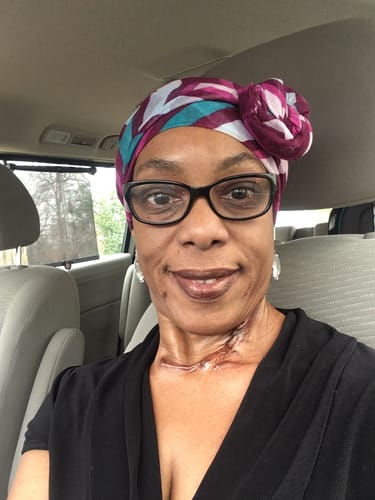 Customer photo review of Sweet Ginger Vapor Rub