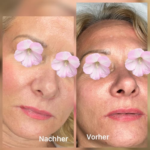 Customer photo review of SQT Recovery Set