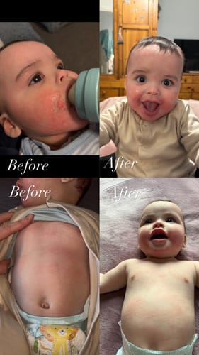 Customer photo review of Calm Balm