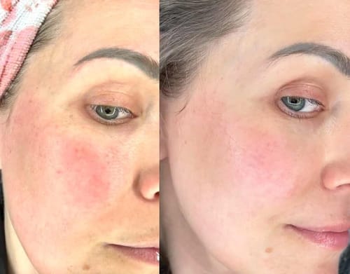 Customer photo review of Bio-Collagen Mask