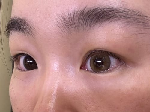 Customer photo review of Iwwitch Up Brown (2pcs) Monthly ( Buy 1 Get 1 Free ) (Silicone Hydrogel) Colored Contacts