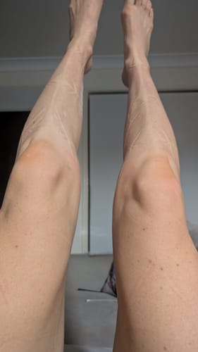 Customer photo review of RECHARGEABLE Full Leg 6 Chamber Air Compression Boots 3.0