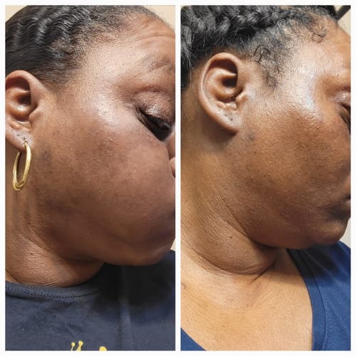 April C. review of Turmeric Brightening Soap (with Vitamin C, Alpha Arbutin, Oat) image 1 out of 3