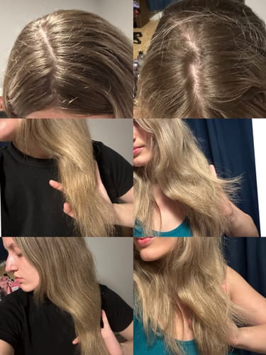 Customer photo review of Pre-Wash Fortifying Rosemary Oil for Scalp