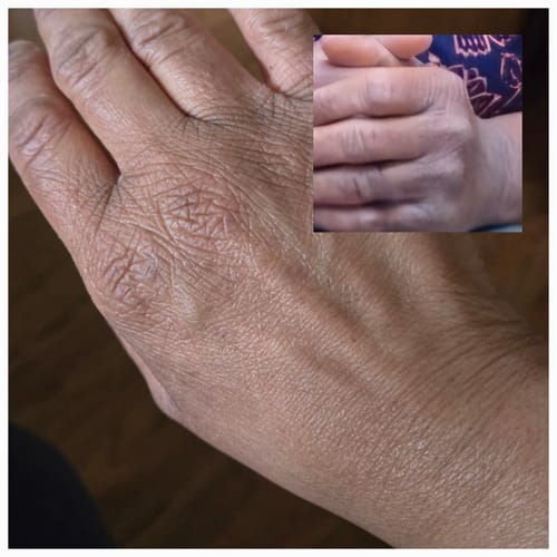 Customer photo review of Sweet Ginger Vapor Rub