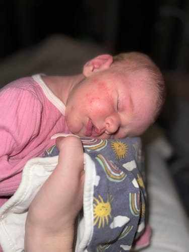 Customer photo review of All Over Ointment Original