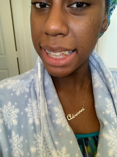 Customer photo review of Upper and Lower Retainers Set