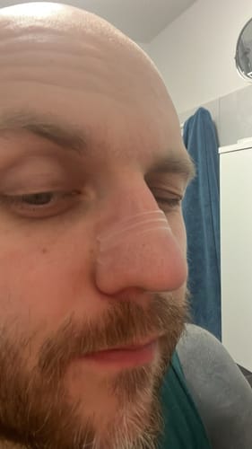 Recenzja produktu Plastry na nos GoodBreath - 50 sztuk ze zdjęciem od klienta