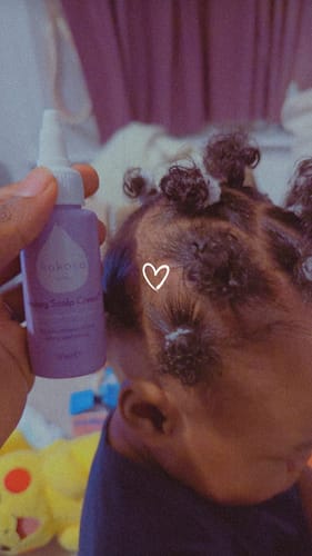 Customer photo review of Happy Scalp Cream™