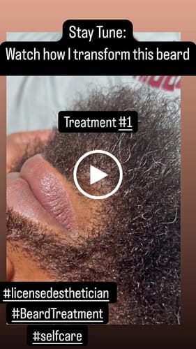 Customer video review of Beard Care Kit
