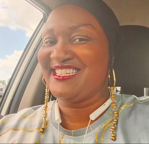 Customer photo review of Flexible Partial Denture, Includes 1 tooth, Save $52 **** Use Code:TCG15 at checkout