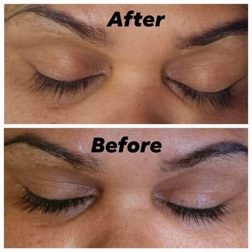 Customer photo review of LASH SERUM