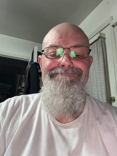 Customer photo review of 2 x Stronger Vital Pump XL Extreme Performance Gummies 2000MG Sale