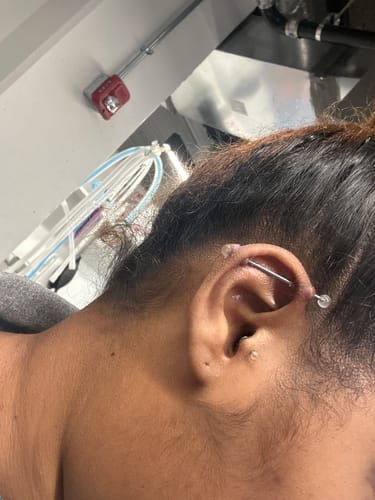 Customer photo review of Piercing Aftercare Hypochlorous Acid Spray