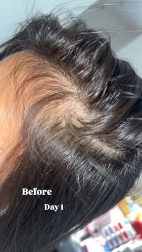 Customer photo review of Pre-Wash Scalp Oil by TR