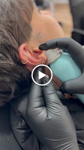 Customer video review of Ultimate Keloid Scar Trio