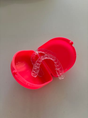 Customer photo review of Premium Upper and Lower Retainer Set