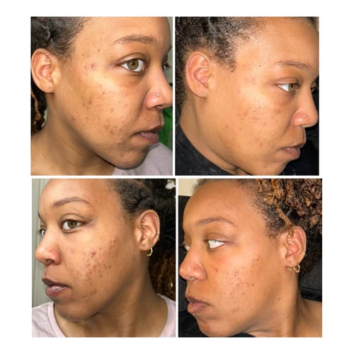 Jakay H. review of Glass Skin Face Kit image 1 out of 1