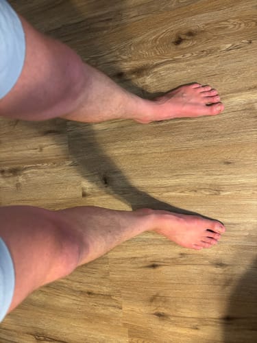 Customer photo review of Shark Tank Starter Bundle