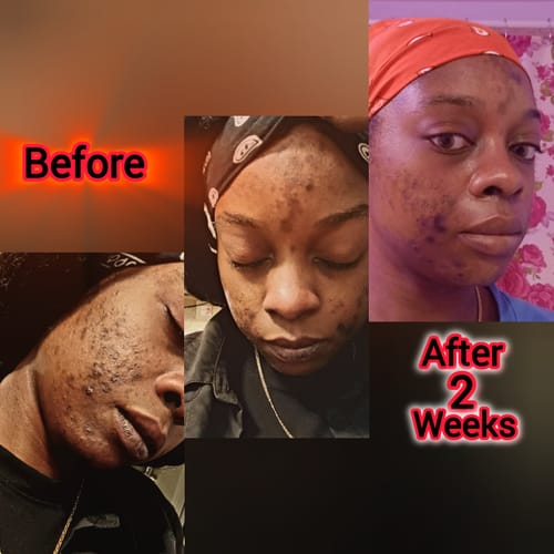 Jeana L. review of Turmeric and Lemon Lip Balm (for Dark Lips) image 1 out of 1