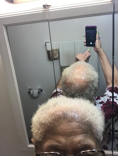 Customer photo review of VIRAL "EXTREME STRENGTH" Hair Growth Serum -