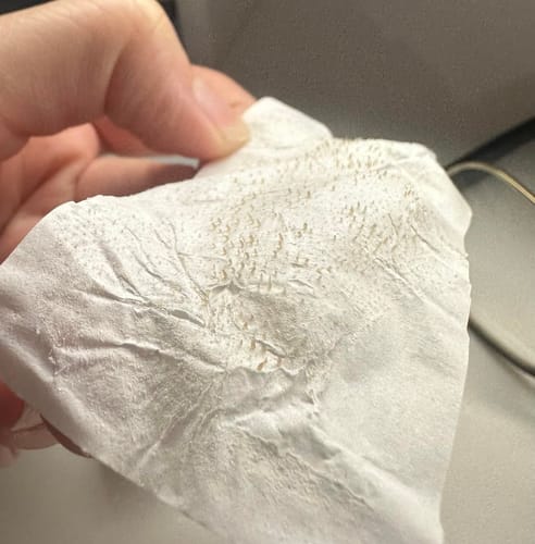 Customer photo review of Deep Cleansing Pore Strips