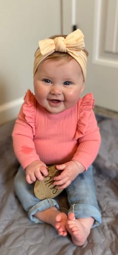 Customer photo review of All Over Ointment Eczema Treatment