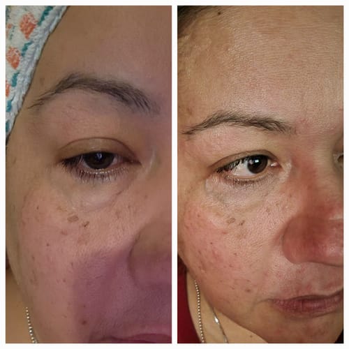 Customer photo review of Juveness Twin-Pack