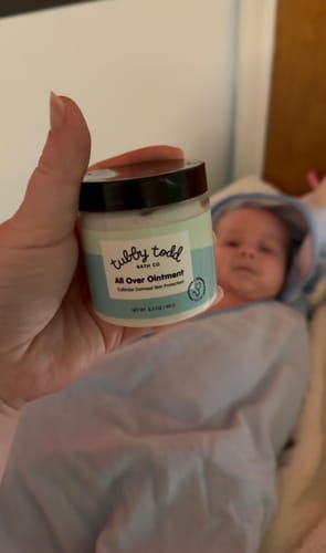 Customer photo review of All Over Ointment Eczema Treatment