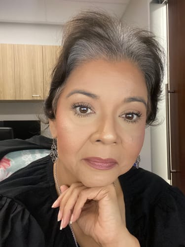 Customer photo review of EYELASH GROWTH SOLUTION