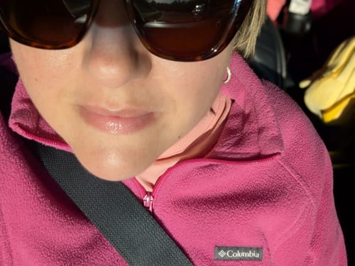 Customer photo review of La La Lips - Moisturizing Lip Balm