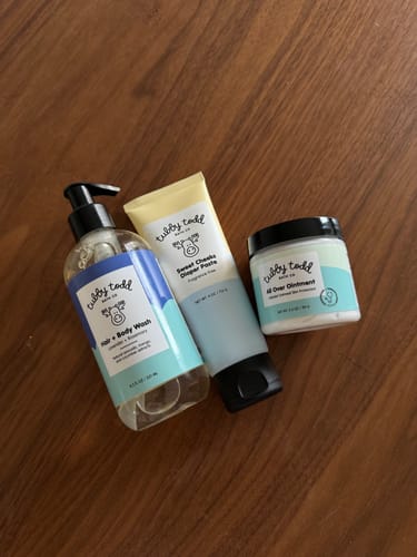 Customer photo review of All Over Ointment Eczema Treatment