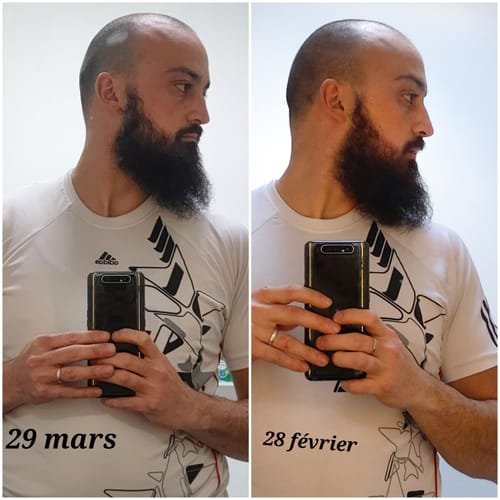 Customer photo review of Shampoing Densifiant Barbe | Nettoyage Doux et Hydratant