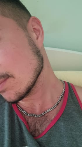 Customer photo review of Dermaroller Barbe Beard-Roller Stimulation Naturelle de la Pousse